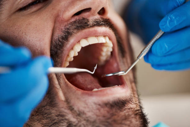 Best After-Hours Emergency Dentist in Woodbury, MN